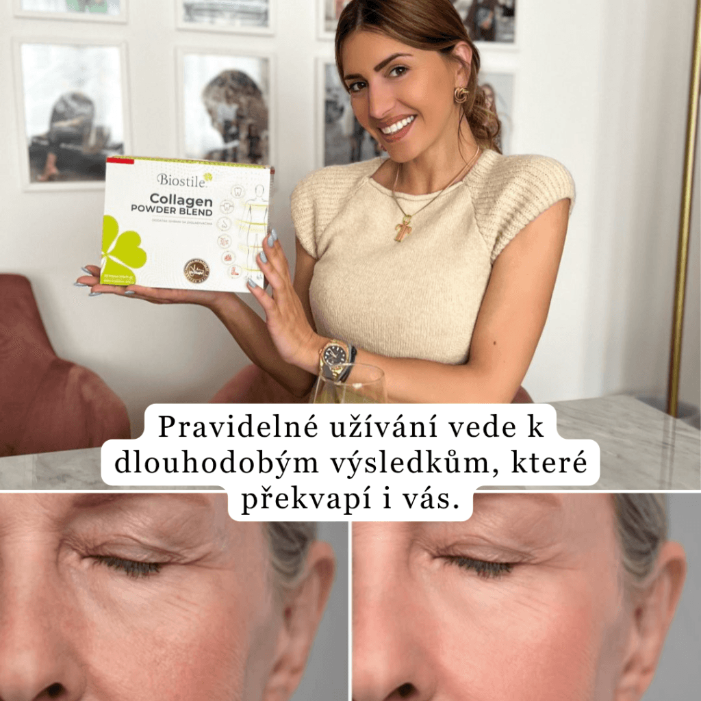 brand collagen s hialuronsko kislino darilo shaker mladosten videz lp 1